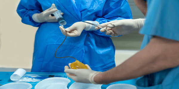 Penis Surgery : Everything you Need to Know – Part 1